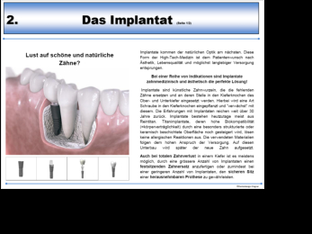 Beispielseite Implantat