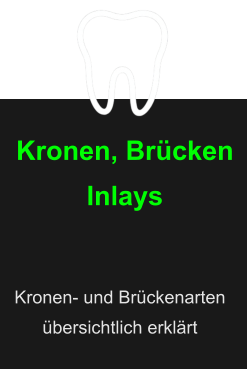 Kronen, BrückenInlays  Kronen- und Brückenarten übersichtlich erklärt