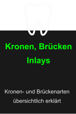 Kronen, BrückenInlays  Kronen- und Brückenarten übersichtlich erklärt