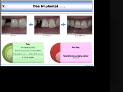 Beispielseite Implantat