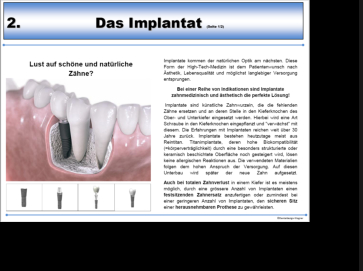 Beispielseite Implantat