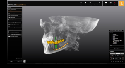 ©Dentaldesign Wagner