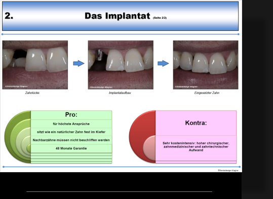 Beispielseite Implantat
